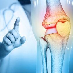 Doctor check and diagnose the Pain in knee joint on medical background. 3d illustration