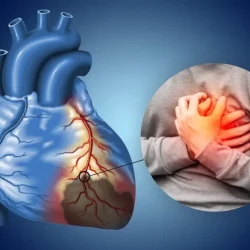 Understanding-Cardiac-Risk-Profiles